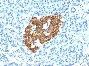 Anti-Pig/Mouse/Rat Insulin Antibody