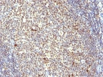 Anti-IPO-38 Antibody (Proliferation Marker)