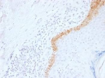 Anti-Cytokeratin 15 Antibody