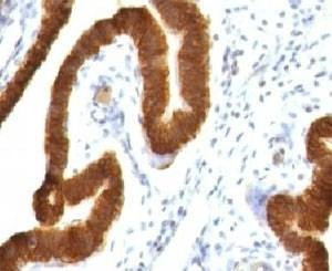 Anti-Keratin 19 Antibody