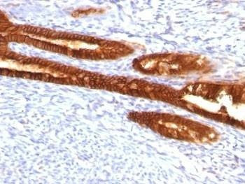 Anti-Keratin 7 Antibody Cocktail