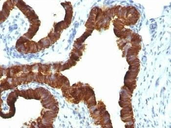 Anti-Keratin 7 Antibody