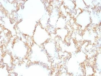 Anti-Keratin 7 Antibody
