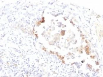 Anti-Blood Group Lewis y Antibody