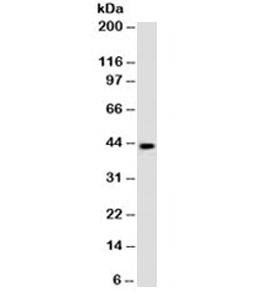 Anti-MAGE-1 Antibody