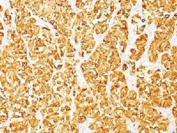 Anti-MART-1 Antibody