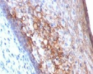 Anti-MCAM Antibody
