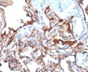 Anti-MCAM Antibody