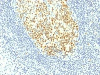 Anti-MCM7 Antibody