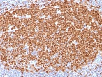 Anti-MCM7 Antibody