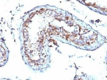 Anti-Moesin Antibody