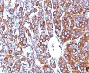Anti-Moesin Antibody