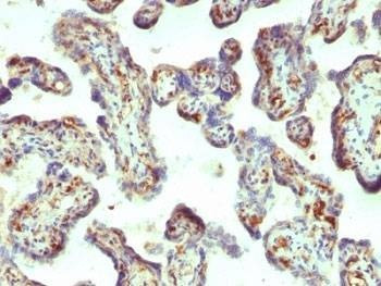 Anti-Moesin Antibody