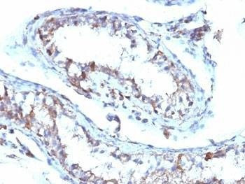 Anti-Moesin Antibody