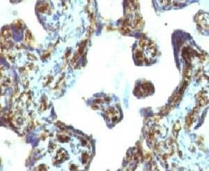 Anti-Moesin Antibody
