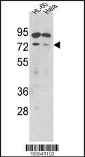Anti-SENP1 (C-term) Antibody