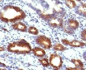 Anti-Mucin-6 Antibody