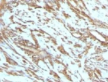 Anti-Muscle Actin Antibody
