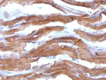 Anti-Muscle Actin Antibody