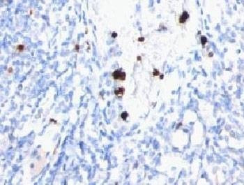 Anti-MYADM Antibody