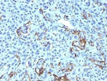Anti-Primates NGF Receptor Antibody Cocktail