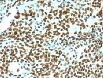 Anti-Nuclear Marker Antibody