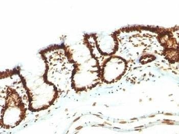 Anti-Nuclear Marker Antibody