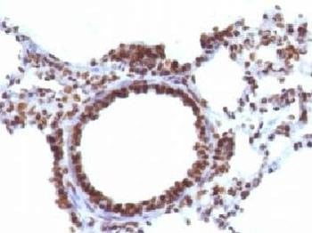 Anti-Nuclear Marker Antibody