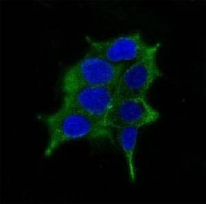 Anti-ODC-1 Antibody