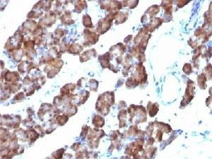 Anti-ODC-1 Antibody