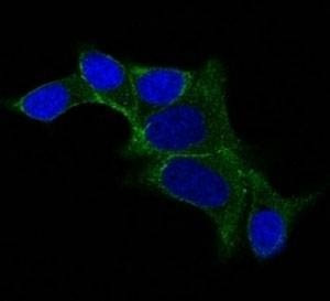 Anti-Ornithine Decarboxylase Antibody