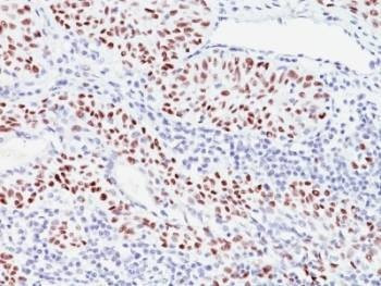 Anti-p57Kip2 Antibody