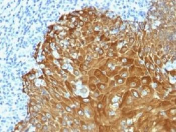 Anti-Pan Cytokeratin Antibody/Acidic + Basic