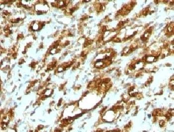 Anti-pan Muscle Actin Antibody
