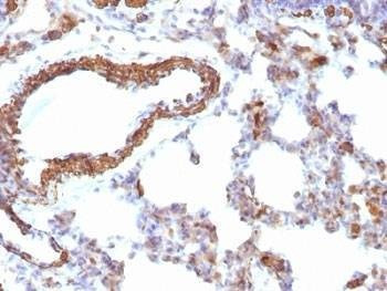 Anti-pan Muscle Actin Antibody