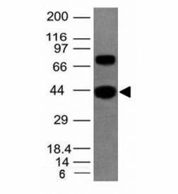 Anti-pan Muscle Actin Antibody