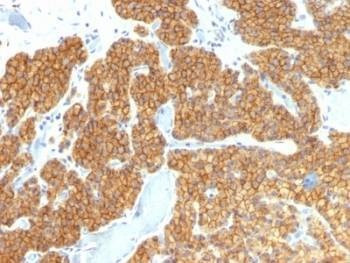Anti-Parathyroid Hormone Antibody
