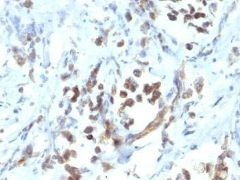 Anti-PAX6 Antibody