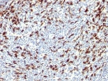 Anti-PDCD1 / PD-1 Antibody