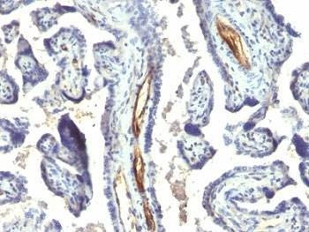 Anti-Podocalyxin Antibody