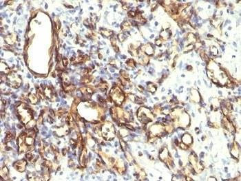 Anti-Podocalyxin Antibody