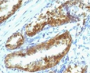 Anti-Prostate Specific Antibody