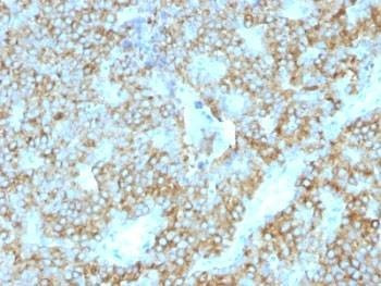 Anti-PTH Antibody