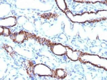 Anti-Cadherin 16 Antibody
