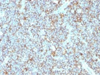 Anti-CD99 Antibody