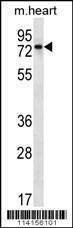 Anti-Mouse PARP2 (C-term) Antibody