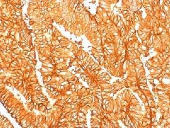 Anti-EpCAM Antibody