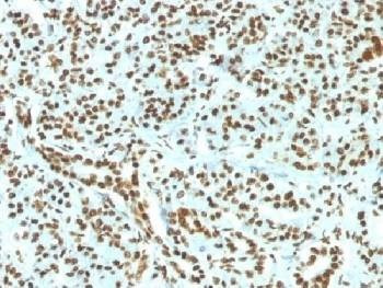 Anti-Histone H1 Antibody