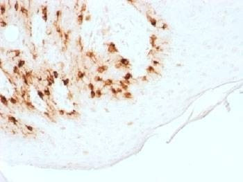 Anti-Melan-A / MART-1 Antibody