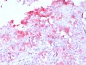 Anti-Melan-A / MART-1 Antibody